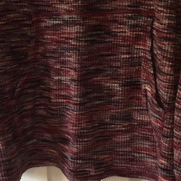 Front pocket detail tunic - Picture 2 of 3